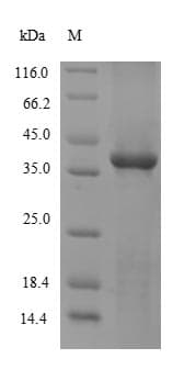 Mouse SULT1A1 / Sulfotransferase 1A1 Protein (Recombinant 10His, N-terminus + Myc, C-terminus)