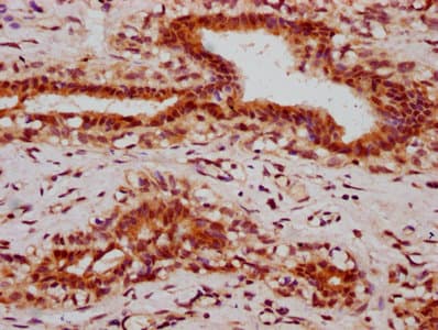 HIST1H2BN Antibody