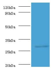 ureA / Urease Alpha Antibody (FITC)