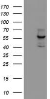 CYP17 / CYP17A1 Antibody (clone OTI3F11)