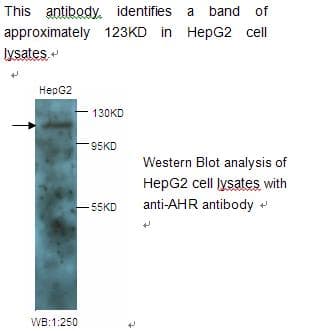 Polyclonal Rabbit anti-Human AHR Antibody (WB)