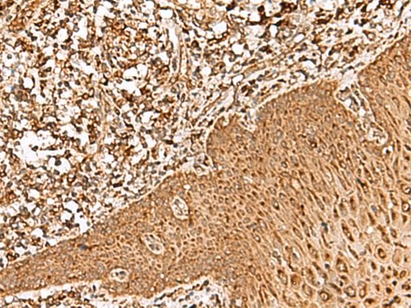 FAM200A Antibody