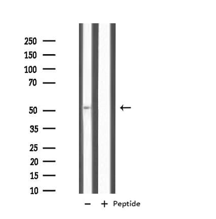 IL11RA Antibody (aa337-364)