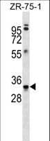 MBP / Myelin Basic Protein Antibody