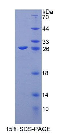 Mouse ABCA8 Protein (Recombinant His-T7, N-terminus)