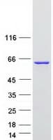 Human NONO / P54NRB Protein (Recombinant Myc-DDK (Flag))