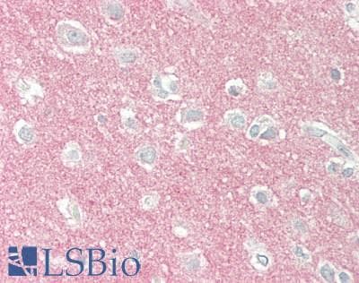 IHC-plus™ SYT1 / Synaptotagmin Antibody