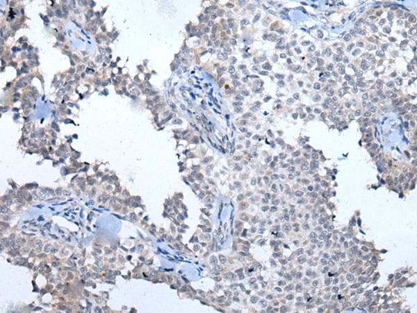 ATM Antibody