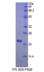 Mouse HBB / Hemoglobin Beta Protein (Recombinant His, N-Terminal)