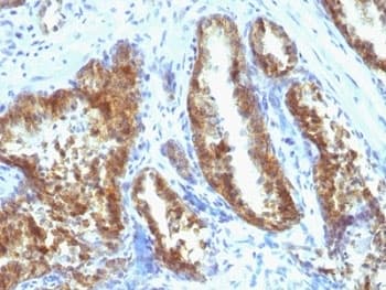KLK3 / PSA Antibody (clone A67-B/E3 + 1A7, Ready-to-Use)