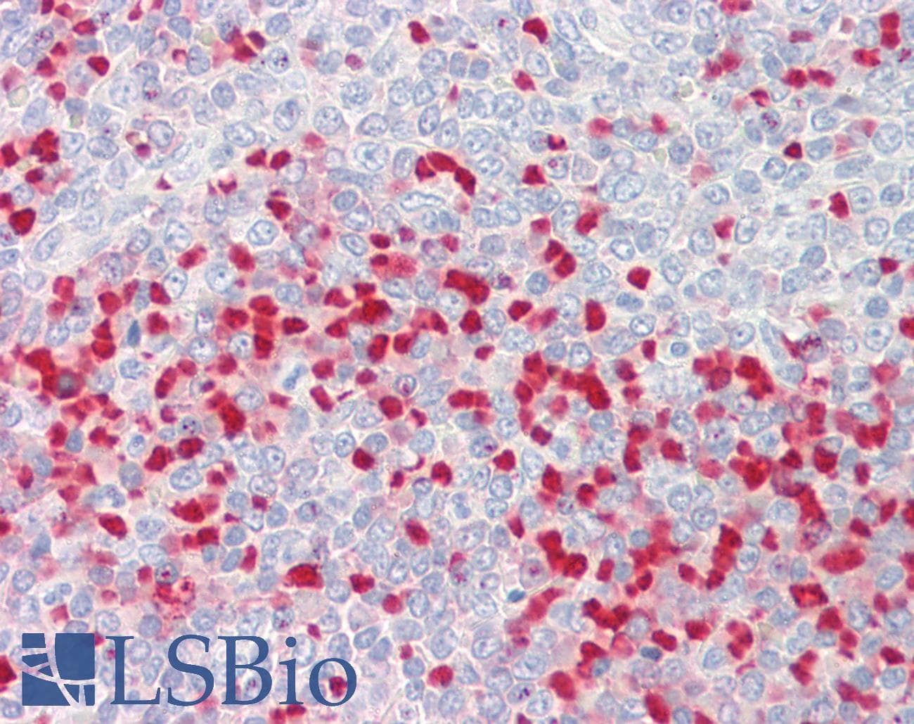 IHC-plus™ Polyclonal Goat anti-Human MTHFR Antibody (aa685-697, IHC)