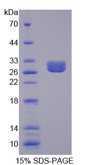 Human PLCG2 / PLC Gamma 2 Protein (Recombinant His-T7)