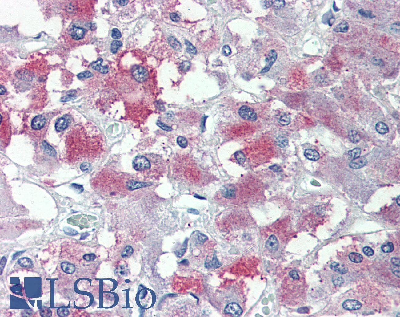 IHC-plus™ THEM6 / C8orf55 Antibody (Internal)
