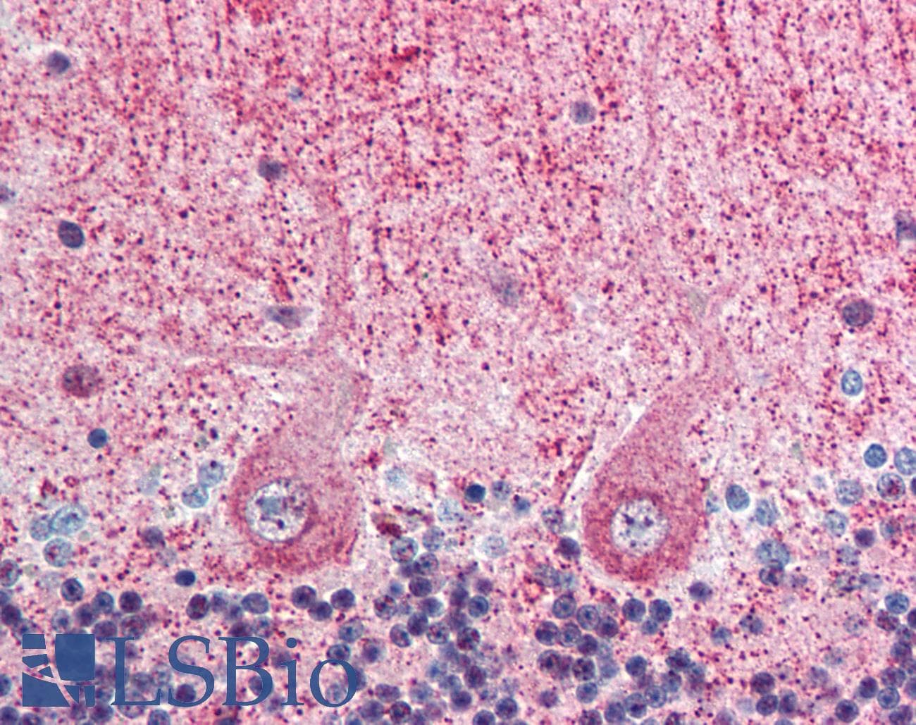 IHC-plus™ EIF3S5 / EIF3F Antibody