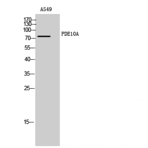 Polyclonal Rabbit anti-Human PDE10A Antibody (40-120 aa, N-terminal, WB)