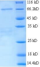 Mouse Alpha-Fetoprotein (Recombinant 6His, N-terminus)