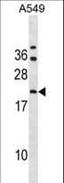 GRPEL2 Antibody (aa14-43)