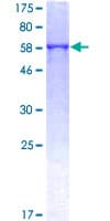 Human ATP6AP2 / Renin Receptor Protein (Recombinant GST)