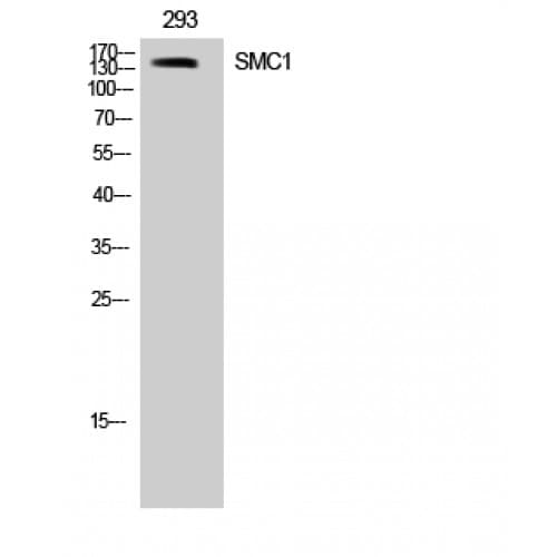 Polyclonal Rabbit anti-Human SMC1A / SMC1 Antibody (900-980 aa, IHC, WB)