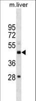 SETD4 Antibody (aa14-41)
