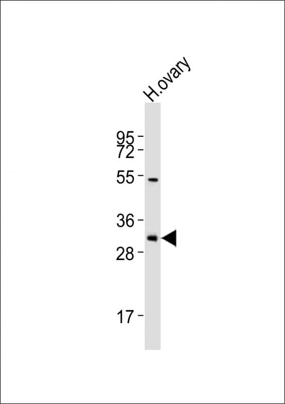 Polyclonal Rabbit anti-Human NBPF12 Antibody (aa148-181, WB)