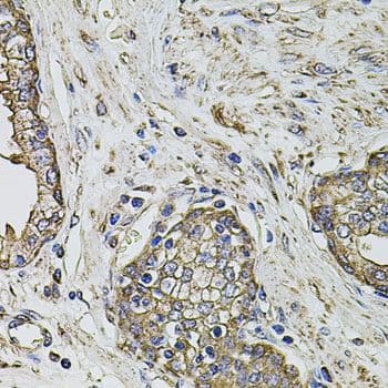 Polyclonal Rabbit anti-Human PTHLH / PTHRP Antibody (IHC, WB)
