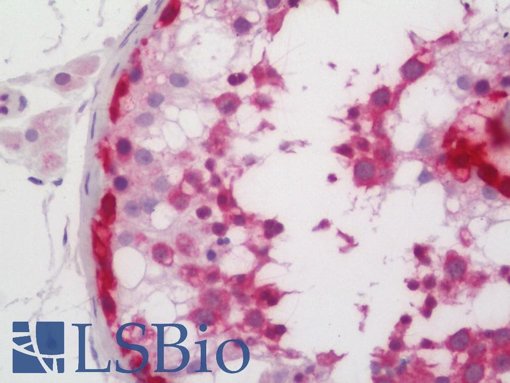 IHC-plus™ TSPYL5 Antibody (aa344-372)