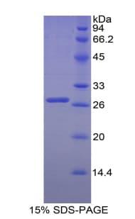 Chicken CD71 / Transferrin Receptor Protein (Recombinant His-S)