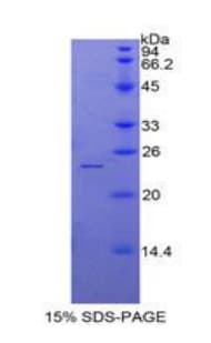 Chicken SPTAN1 / Alpha Fodrin Protein (Recombinant His)