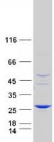 Human ABHD14B Protein (Recombinant Myc-DDK (Flag))
