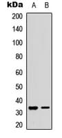 RPA2 / RFA2 / RPA34 Antibody (N-Terminus)