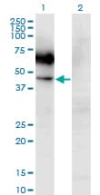 CSF2RA / CD116 Antibody (clone 2G5)
