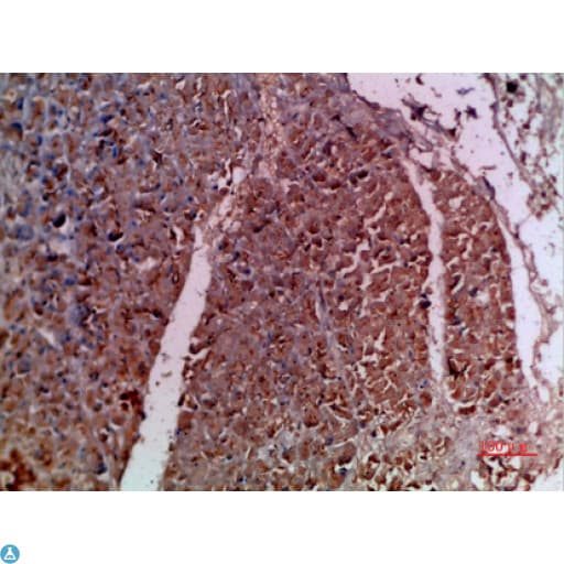 IL20 Antibody