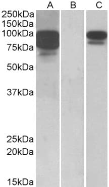 Polyclonal Goat anti-Human PCSK9 Antibody (aa214-228, WB)