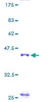Human TNNC2 Protein (Recombinant GST)