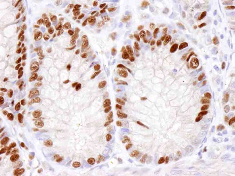 PathPlus™ MCM2 Antibody (aa1-50)