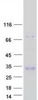Human Adiponectin Protein (Recombinant Myc-DDK (Flag))