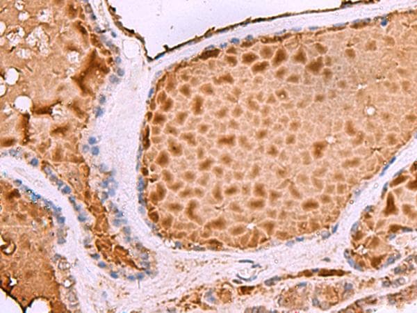 ASTE1 Antibody