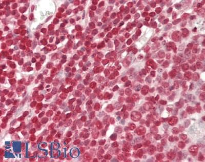 IHC-plus™ Polyclonal Rabbit anti-Human IRF1 / MAR Antibody (Internal, IHC, WB)