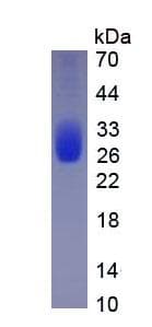 Dog IL6 / Interleukin 6 Protein (Recombinant His, N-Terminal)