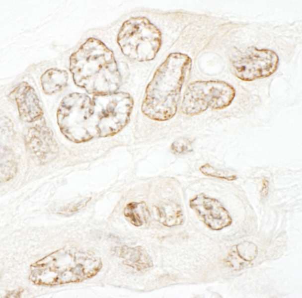 Polyclonal Rabbit anti-Human SETD1B / SET1B Antibody (aa350-400, IHC)