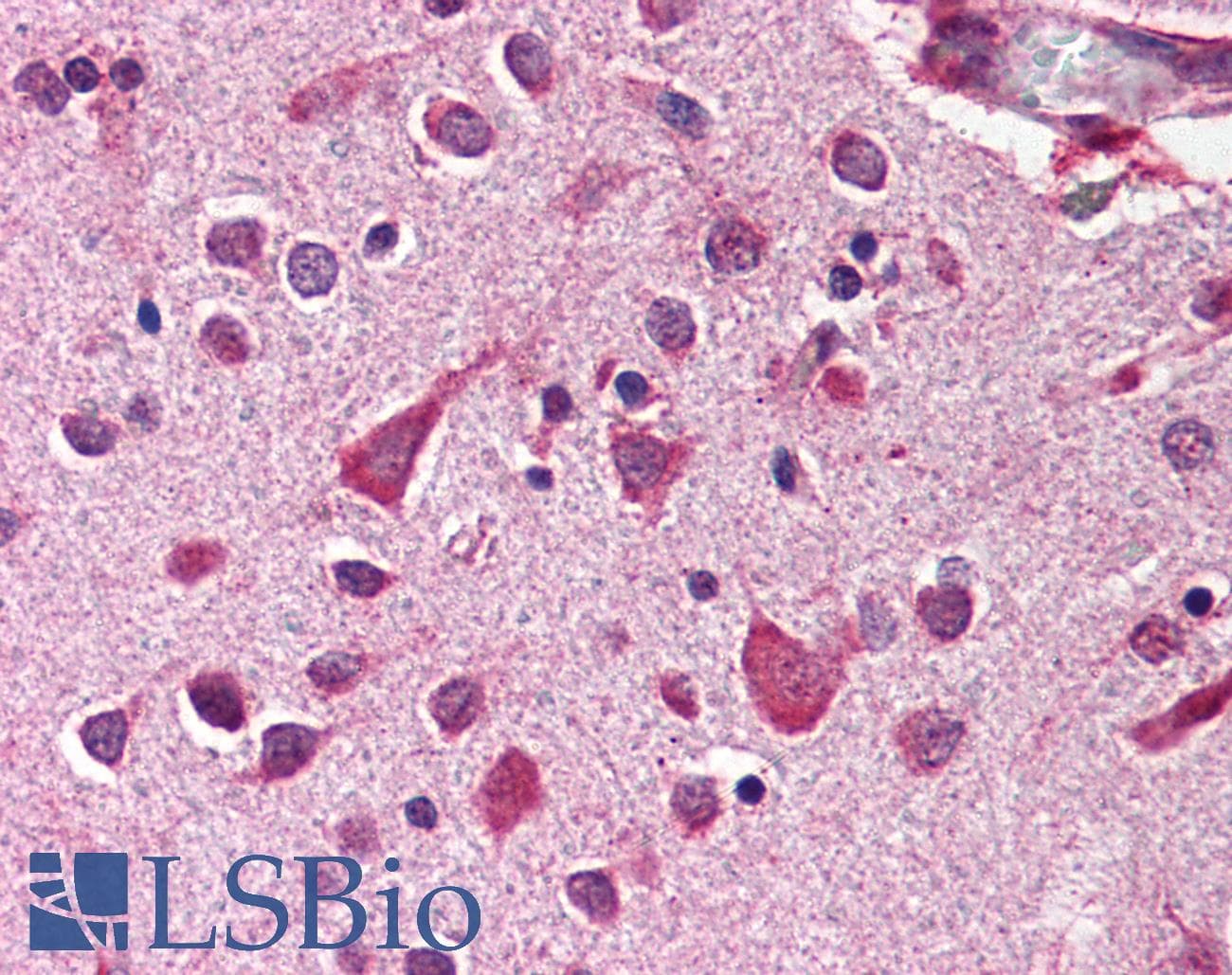 IHC-plus™ Polyclonal Rabbit anti-Human MCL1 / MCL 1 Antibody (IHC, IF, WB)