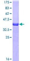 Human TTR / Transthyretin Protein (Recombinant GST)