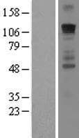 GLI / GLI1 Protein (Over-Expression Lysate Myc-DDK (Flag))