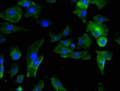 Polyclonal Rabbit anti-Human SERPINE1 / PAI-1 Antibody (WB)