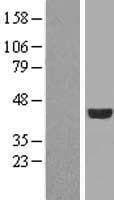 FGFR1OP / FOP Protein (Over-Expression Lysate Myc-DDK (Flag))
