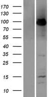 TNFAIP3 / A20 Protein (Over-Expression Lysate Myc-DDK (Flag))
