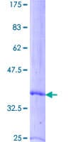 Human CXCL7 / PPBP Protein (Recombinant GST)
