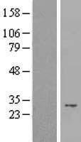 Human TNFSF5IP1 / CLAST3 Protein (Over-Expression Lysate Myc-DDK (Flag))