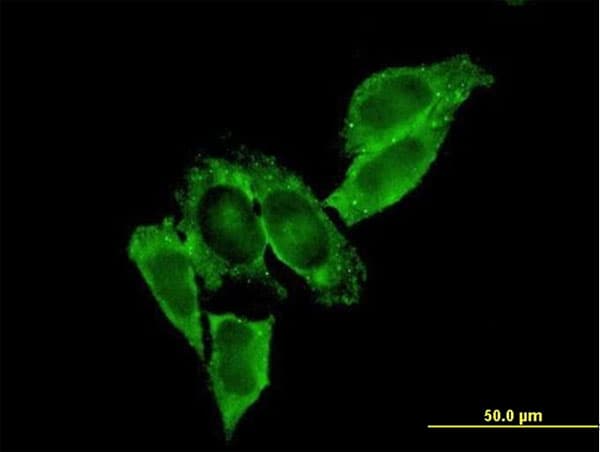 MMP9 / Gelatinase B Antibody (clone 2H4)